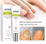 Efro Nail Repair Esseence Gel Fungal Nail