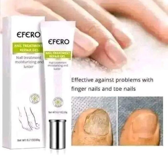 Efro Nail Repair Esseence Gel Fungal Nail